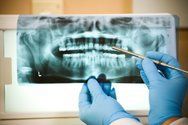 Dentist Reviewing X-Ray - Utica, NY