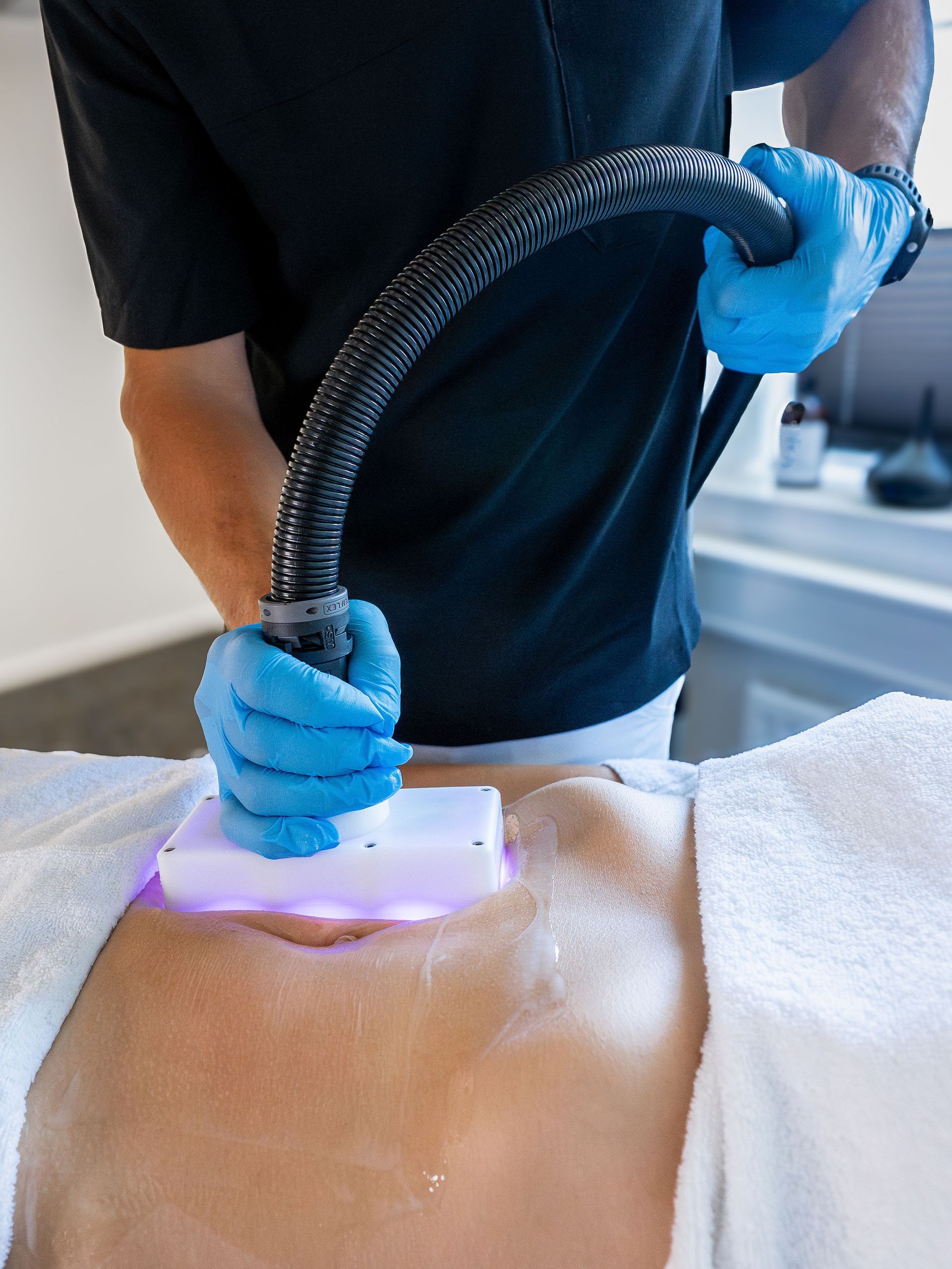 Cryobehandling av mageområde