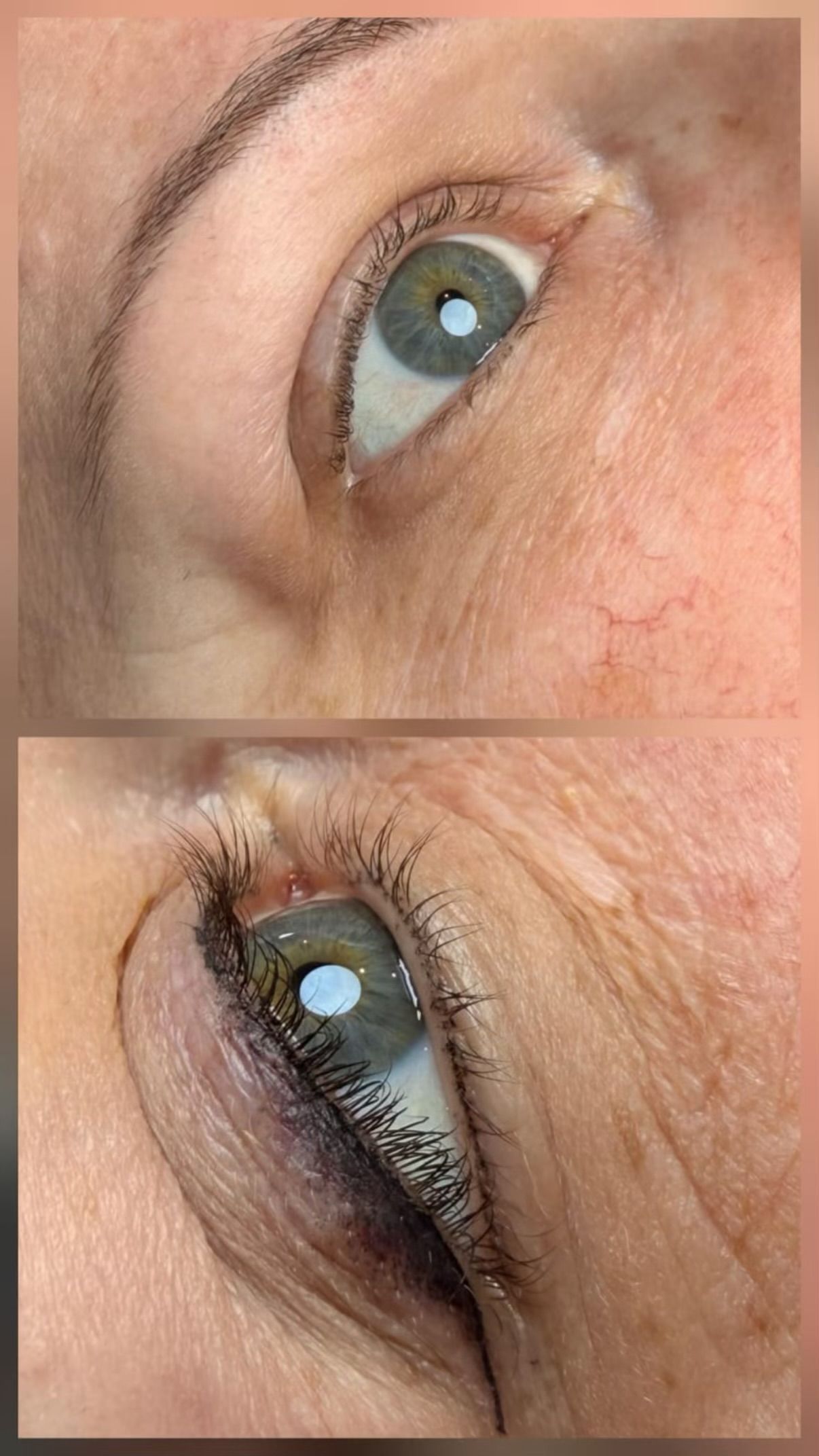 Nahaufnahme eines blauen Auges, gezeigt in zwei nebeneinanderliegenden Ansichten geöffnet und geschlossen.