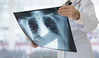 Insurance Plans — Doctor Holding X-Ray Result in Dover, PA