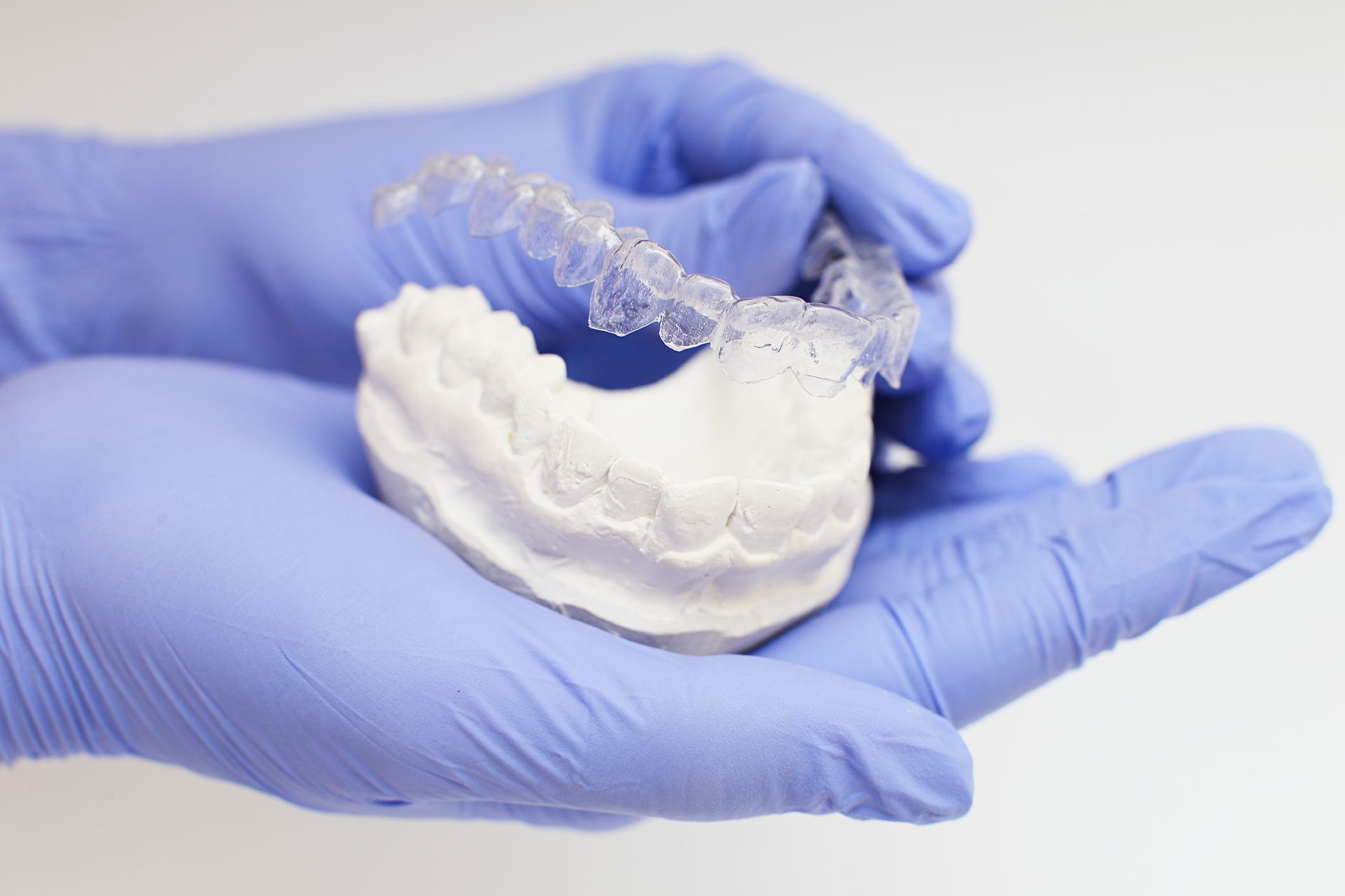 A Person Wearing Blue Gloves Is Holding A Model Of Teeth — Aspire Dental in Townsville, QLD