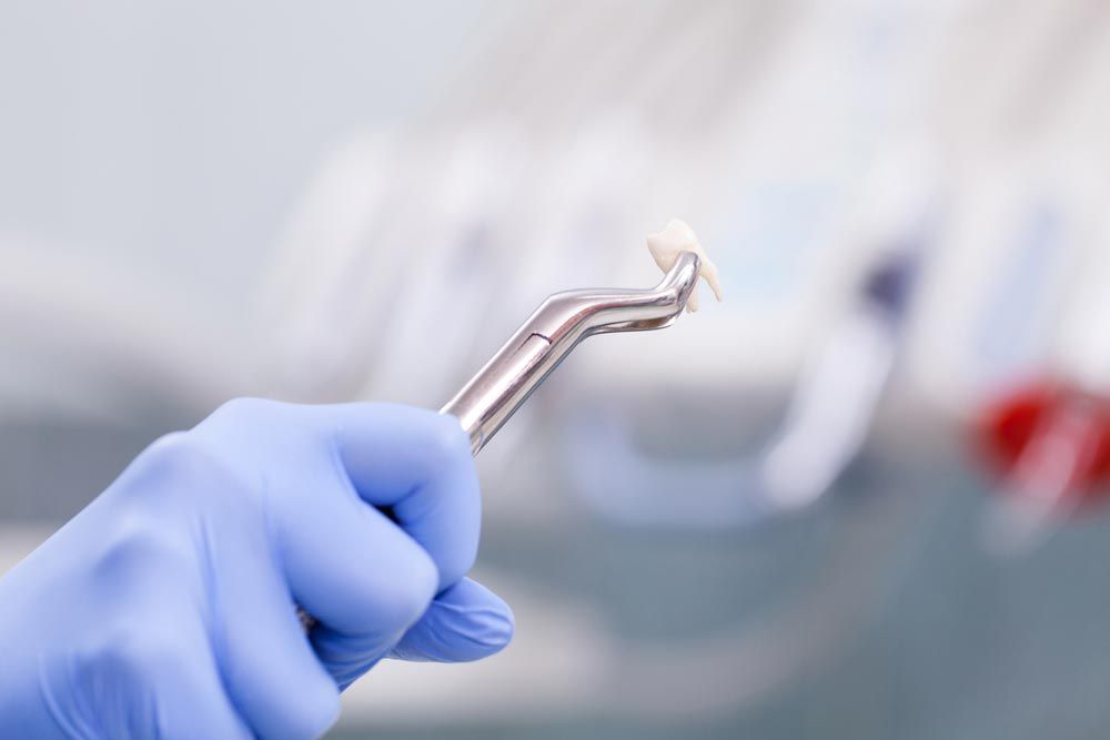 Dentist Holding An Extracted Tooth