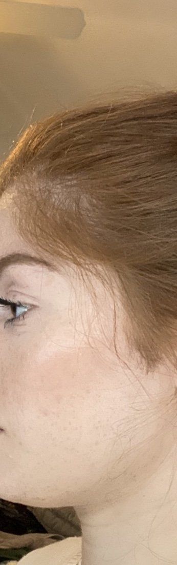 Woman's Face — Franklin, TN — Electrolysis & Skin Care By Marina