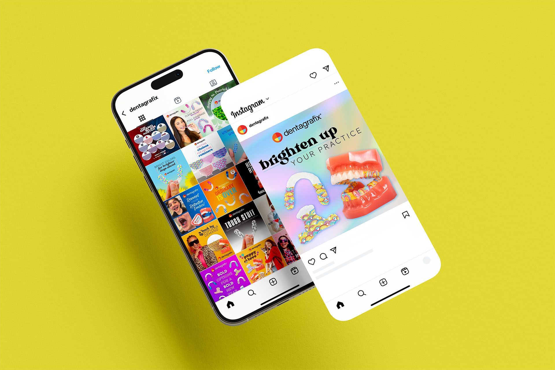 Two phones are sitting next to each other on a yellow background.