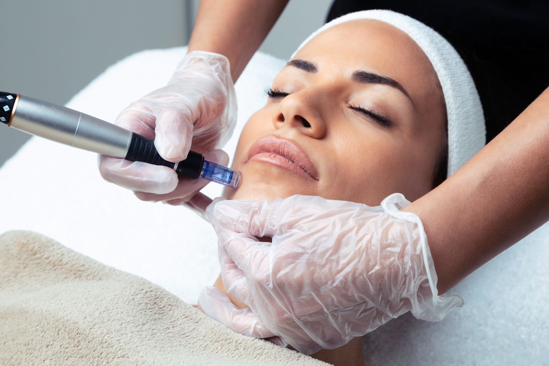 Woman receiving microneedling treatment on her face while lying down. Hands in gloves, medical device visible.
