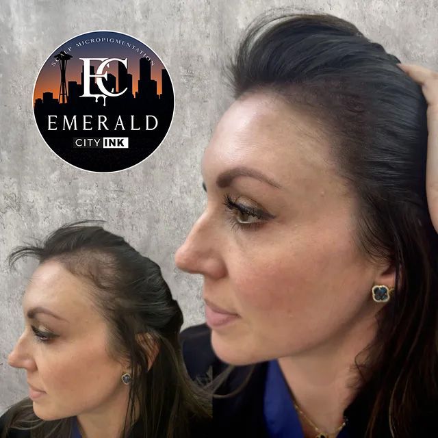 Woman with thinning hairline, after micro-pigmentation treatment, Emerald City Ink.