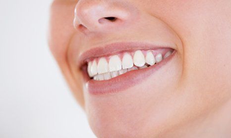 White, healthy teeth