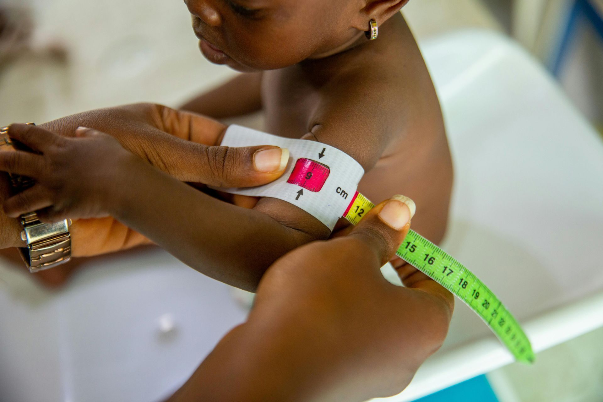 Person measuring a child's arm circumference with a tape measure, checking for malnutrition.