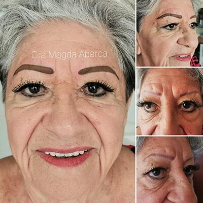 Mediestética Acapulco – faciales