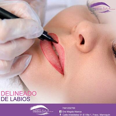 Mediestética Acapulco - delineado de labios