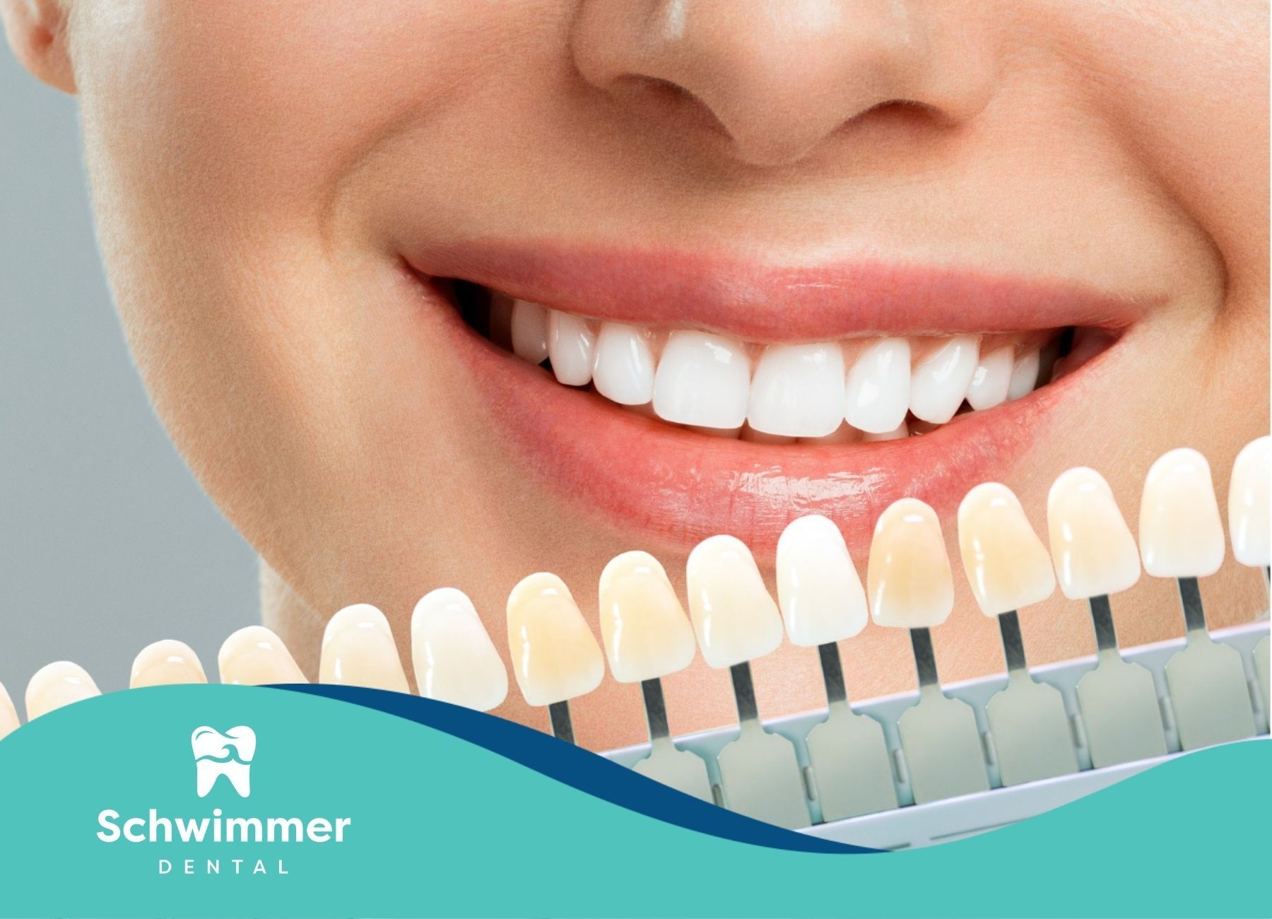 A close up of a woman's smile with a palette of teeth shades.
