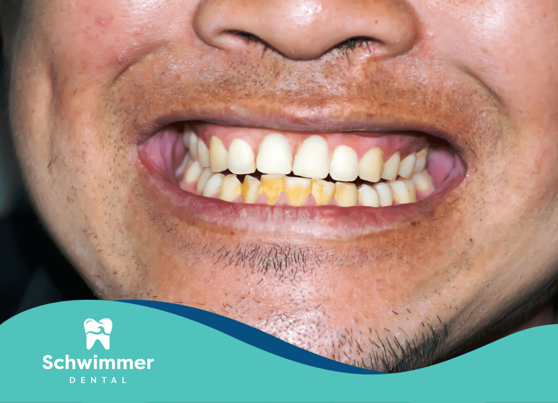 Cheerful man in close-up, smiling brightly with radiant, healthy teeth and joyful expression.