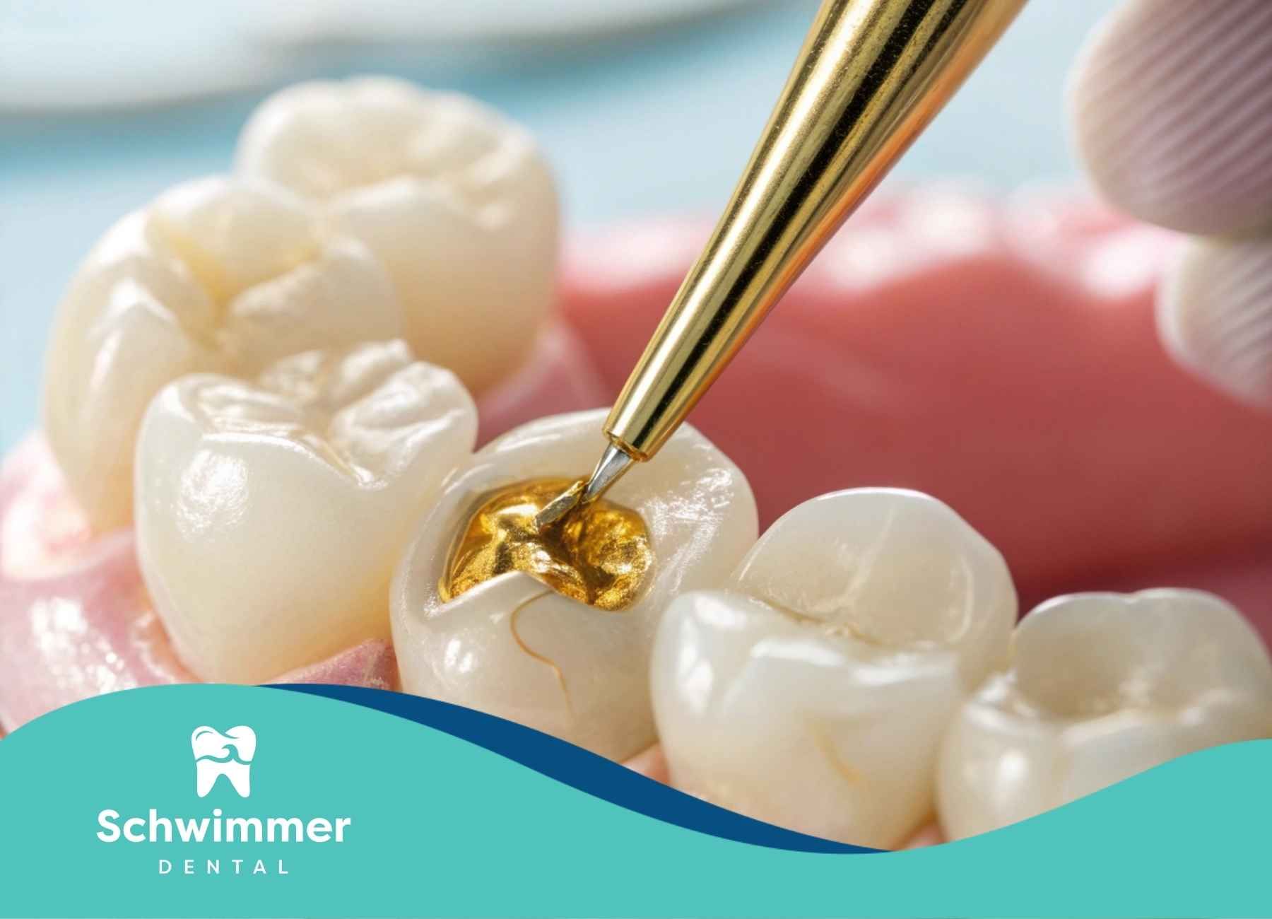 Dentist filling a tooth with a gold filling; detail of teeth and tools.