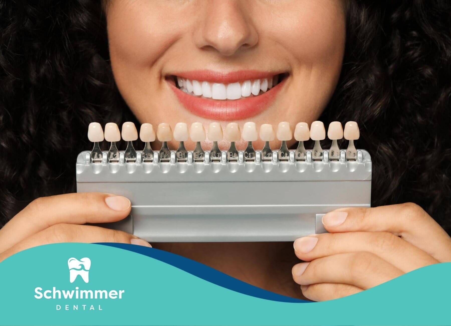 Smiling woman holding a set of dental shade guide samples in front of her teeth.
