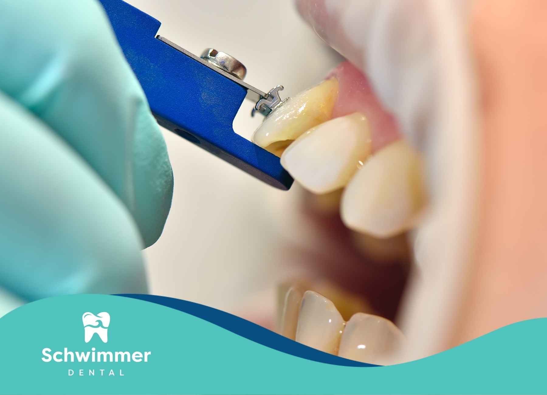 A person is getting their teeth examined by a dentist.