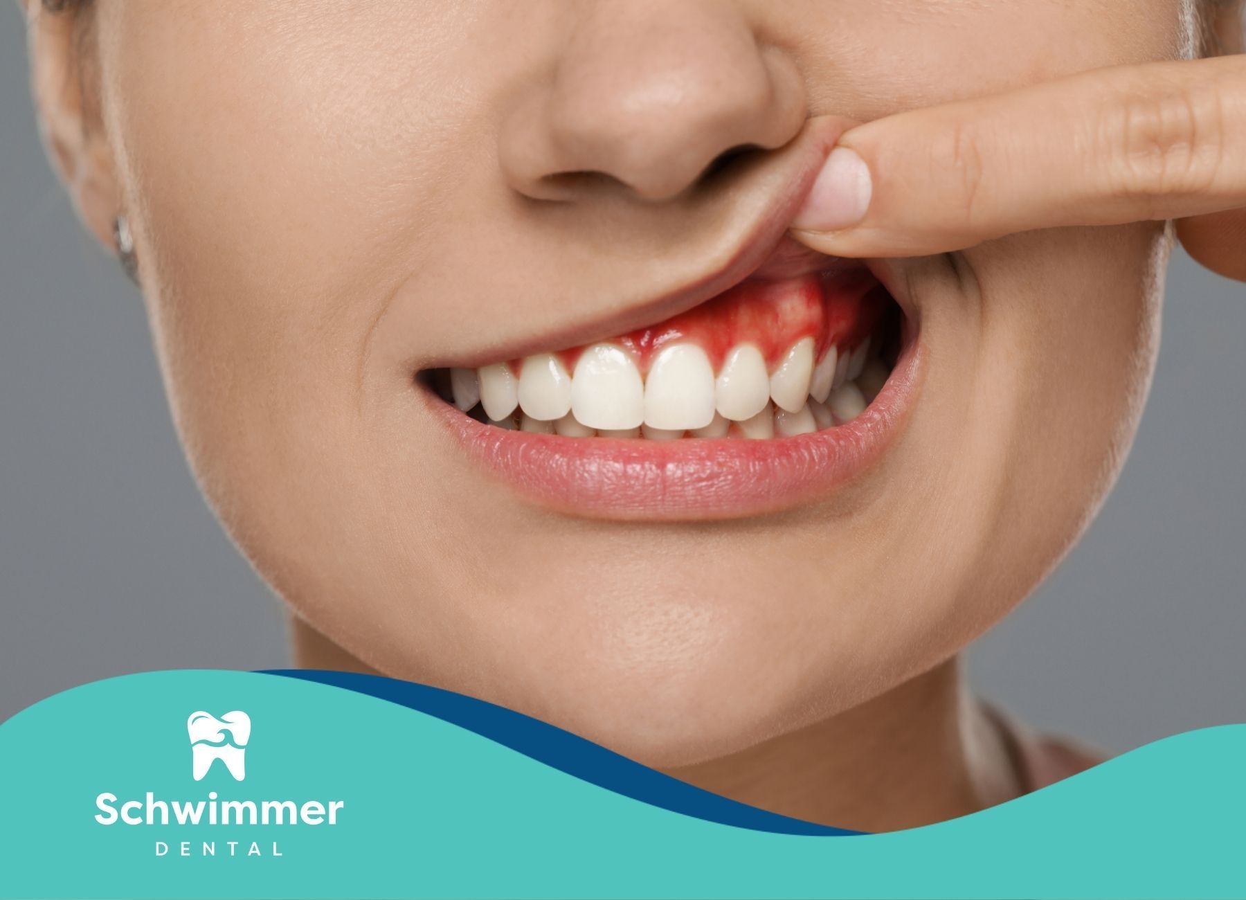 A close up of a woman 's teeth with a swimming dental logo in the corner.