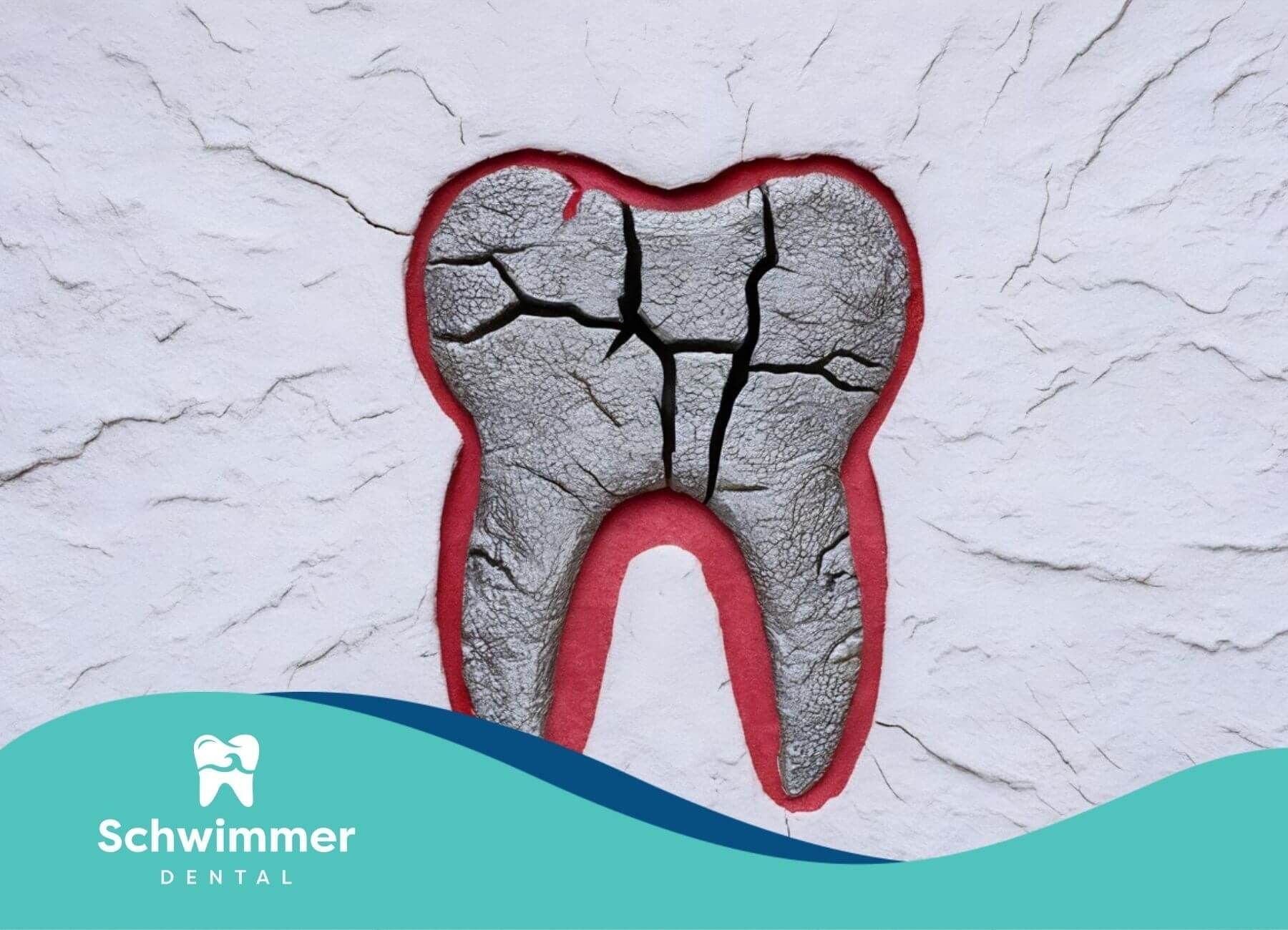 Illustration of a cracked and damaged tooth on textured background.