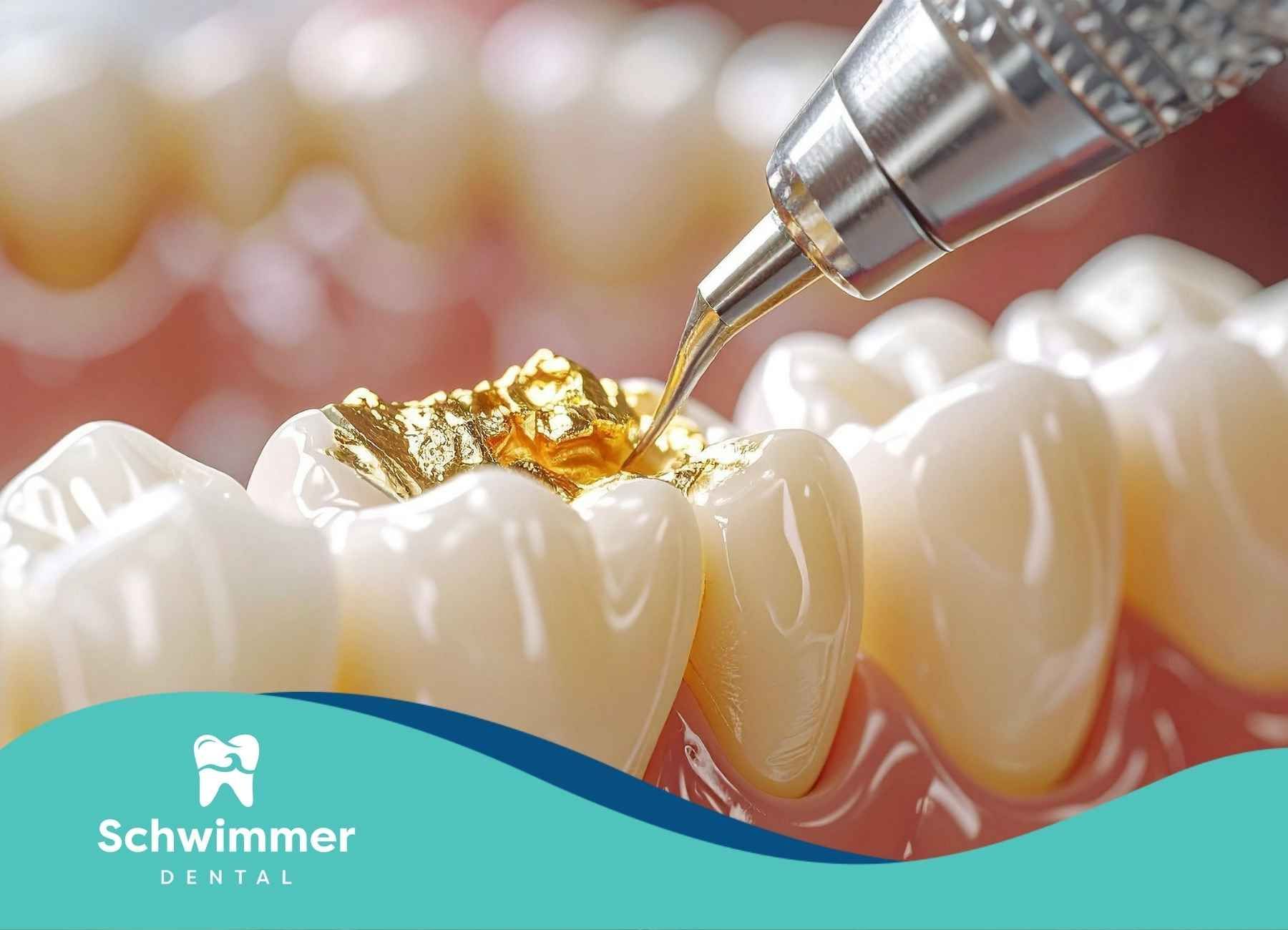 Dental tool filling a tooth with gold. Close-up on teeth, pink gums, and dental equipment.