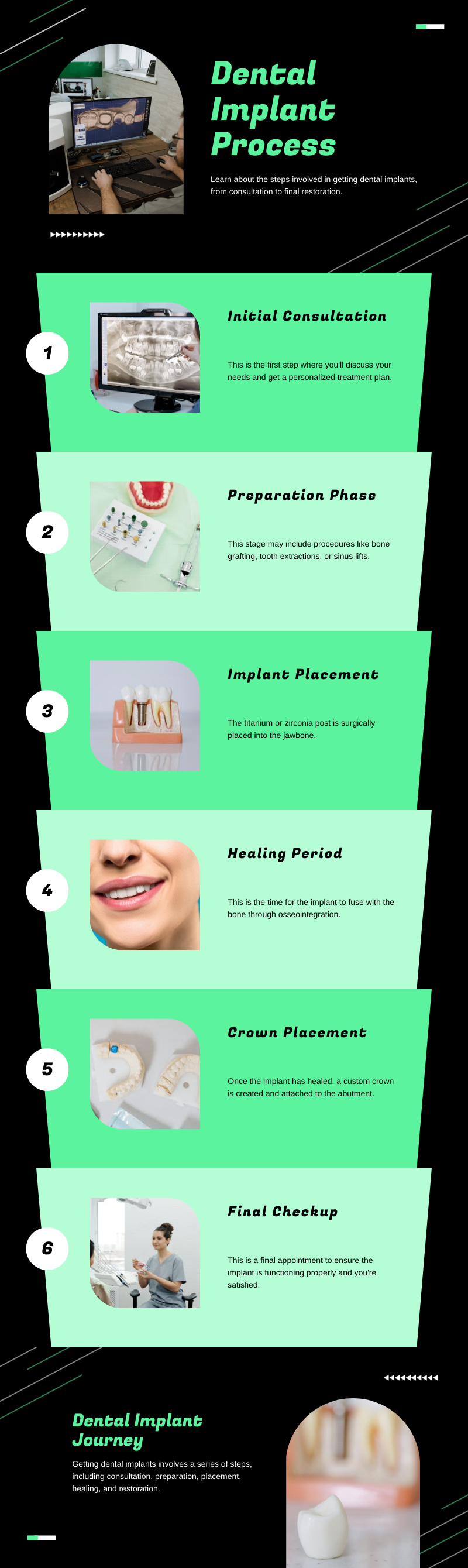 infographic about dental implant process step-by-step