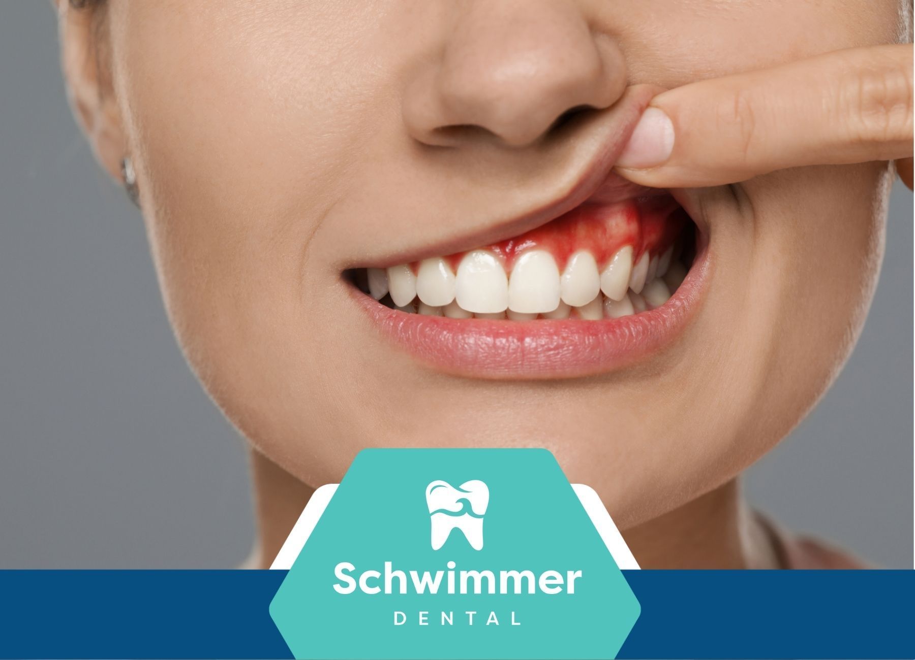 A close up of a woman 's teeth with a swimming dental logo in the corner.