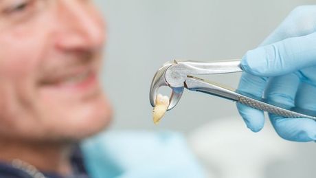 a man is getting his teeth removed by a dentist