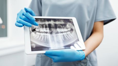 a dentist is holding a tablet with an x-ray of her teeth on it
