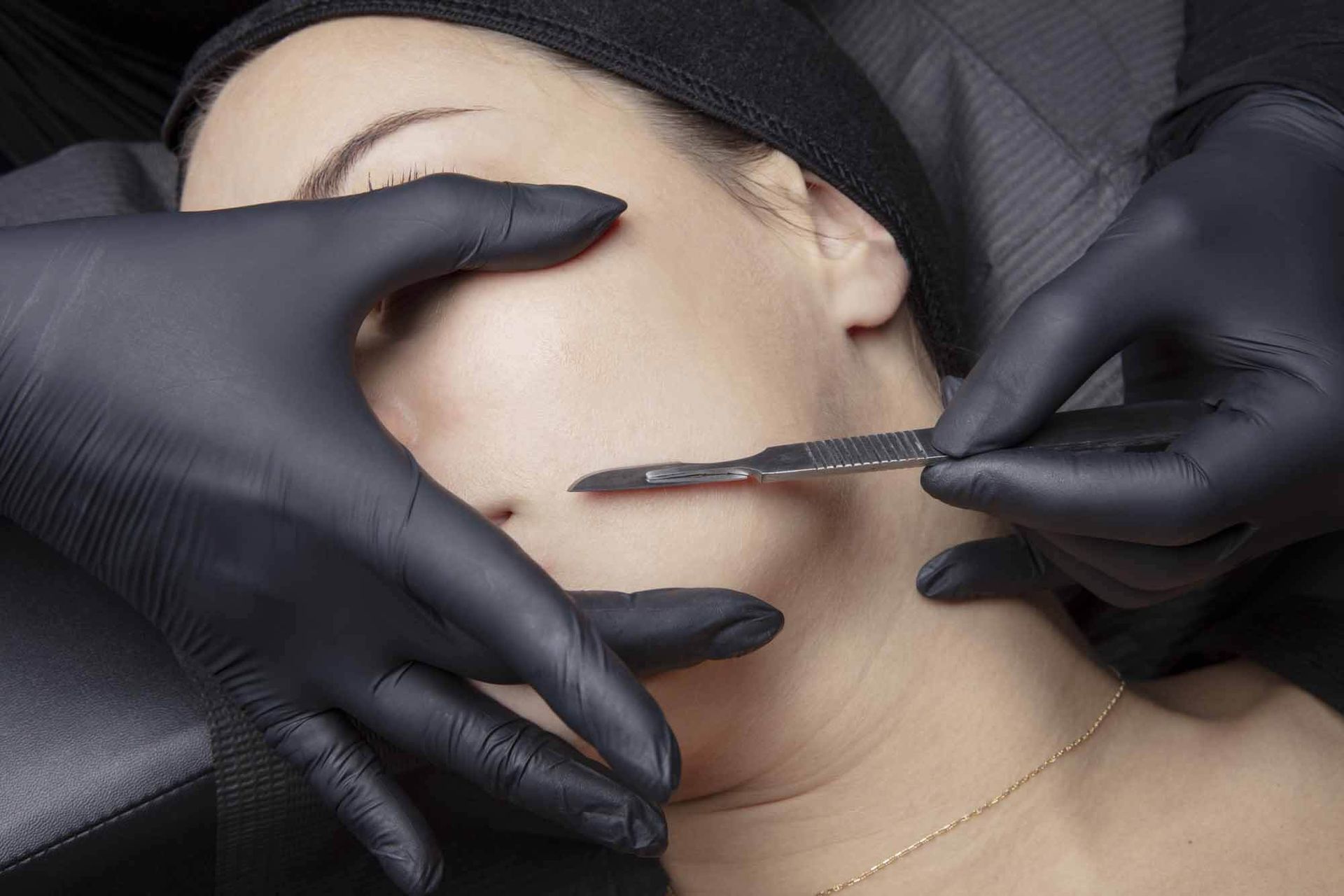 A woman is getting her face waxed by a person wearing black gloves.