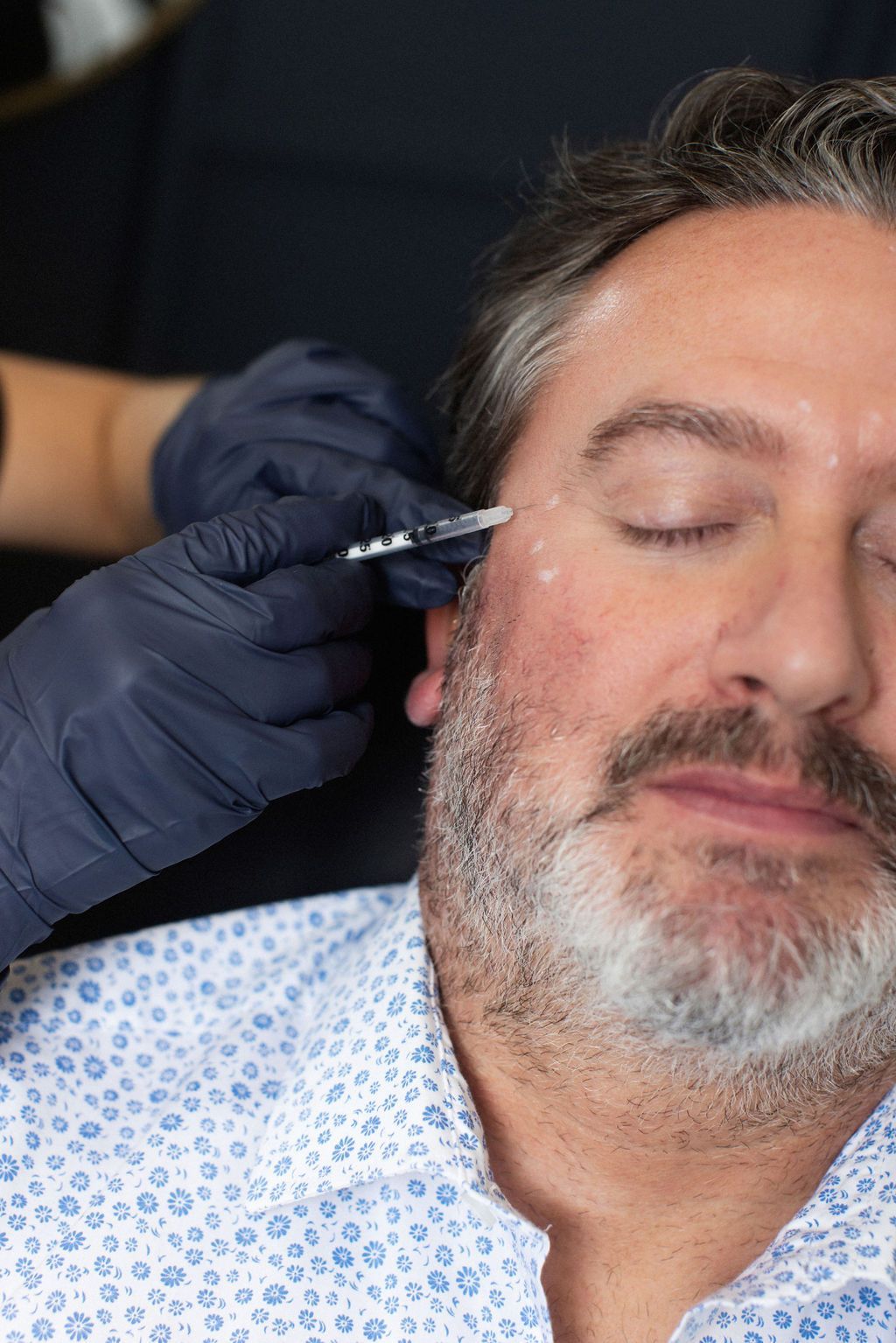 A man with a beard is getting a botox injection in his forehead.