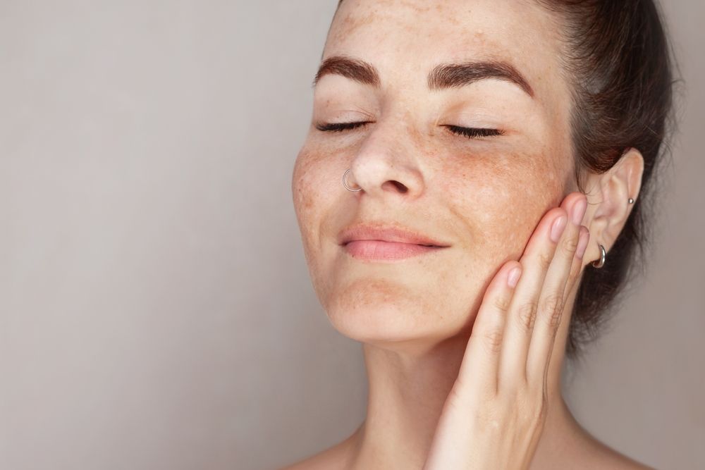 A woman with freckles is touching her face with her hand.