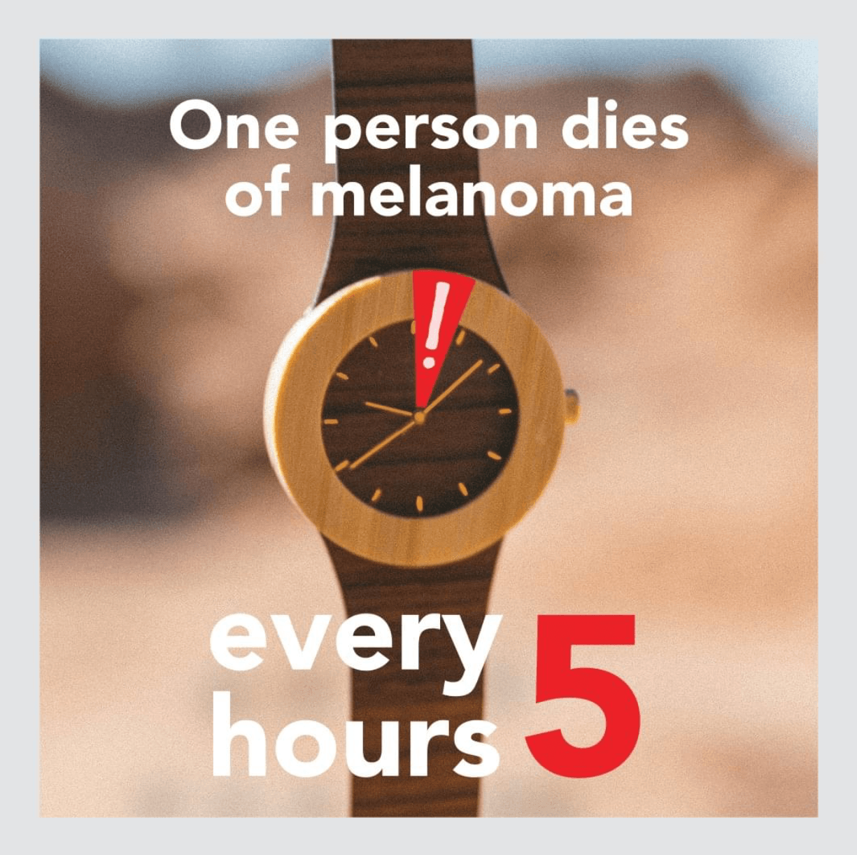 melanoma
