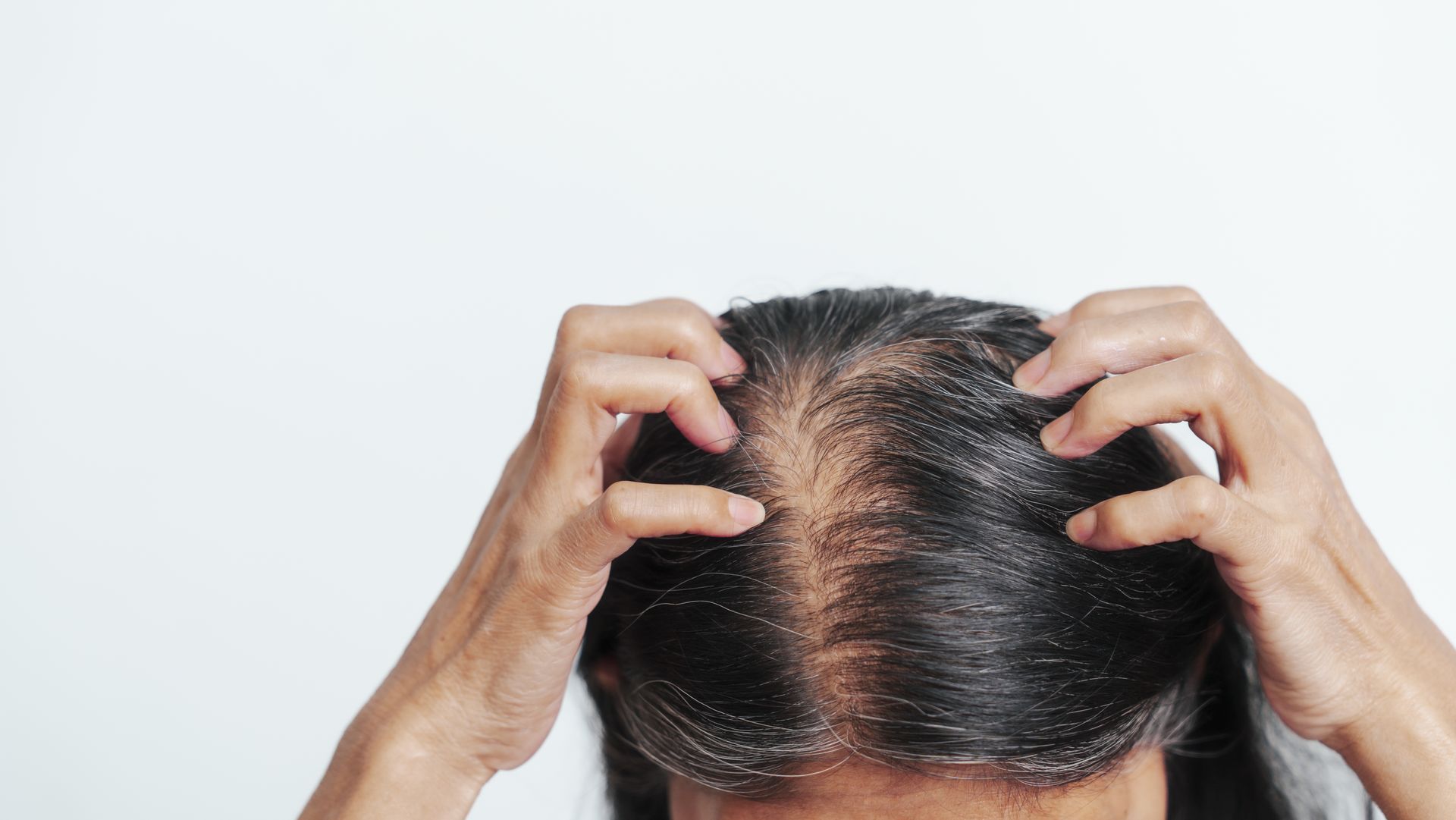 hair-loss-in-women-treatments-options-tampa