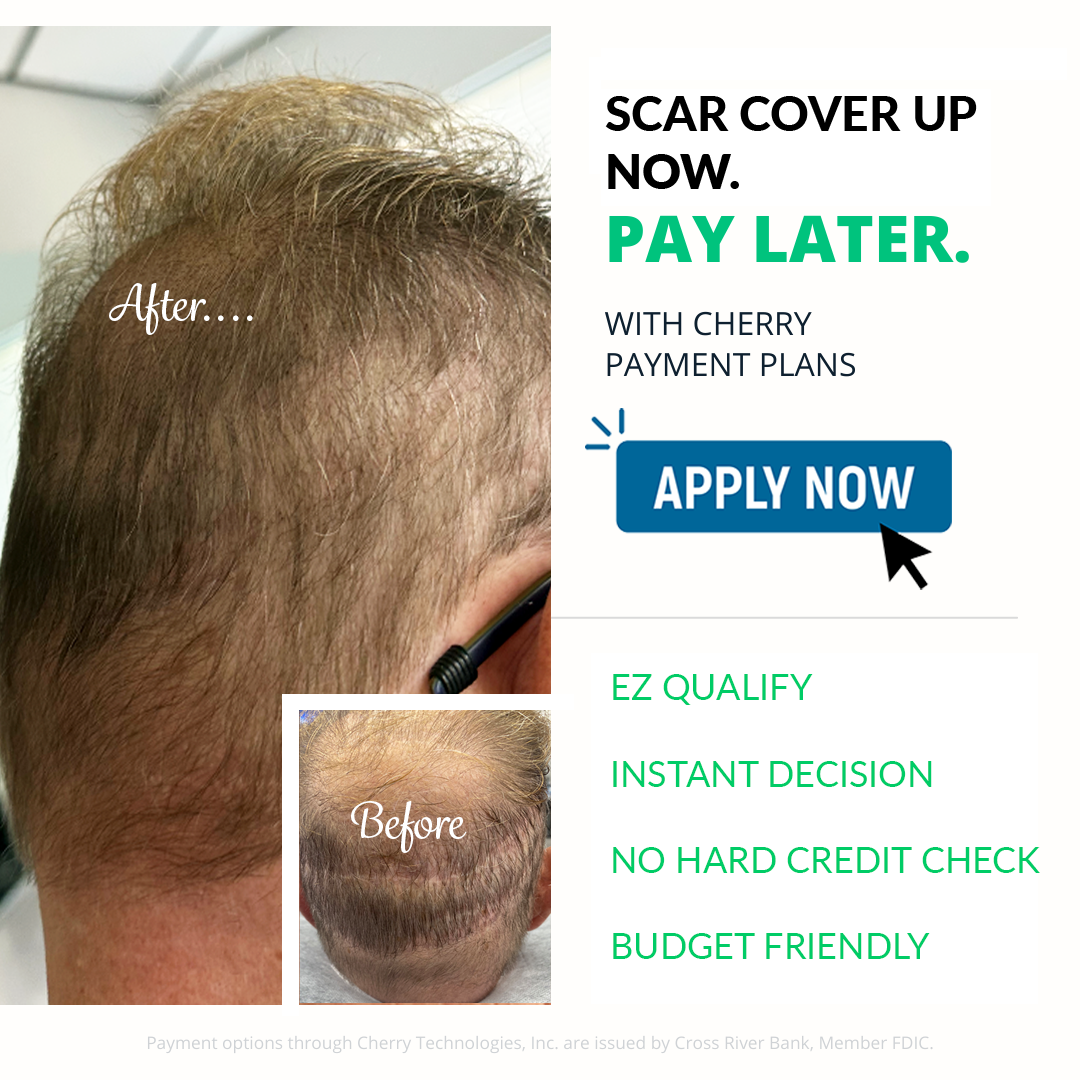 Hair Transplant Scar Cover Up Tampa