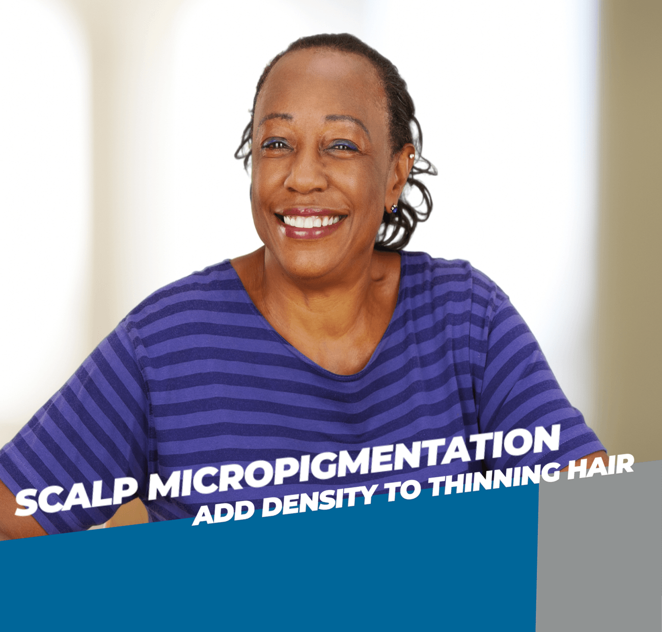 Benefits of scalp micropigmentation