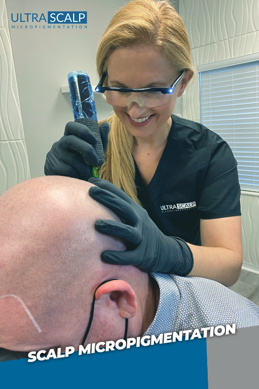 Best scalp micropigmentation Clinic Tampa - Ultra Scalp