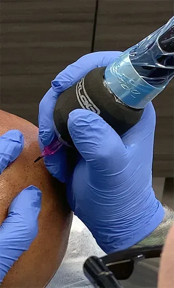 Best scalp micropigmentation Clinic Tampa - Ultra Scalp