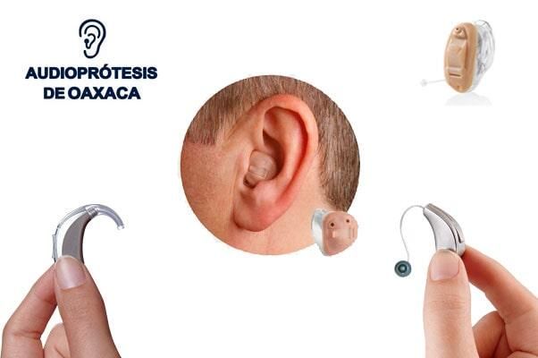Audioprótesis Oaxaca