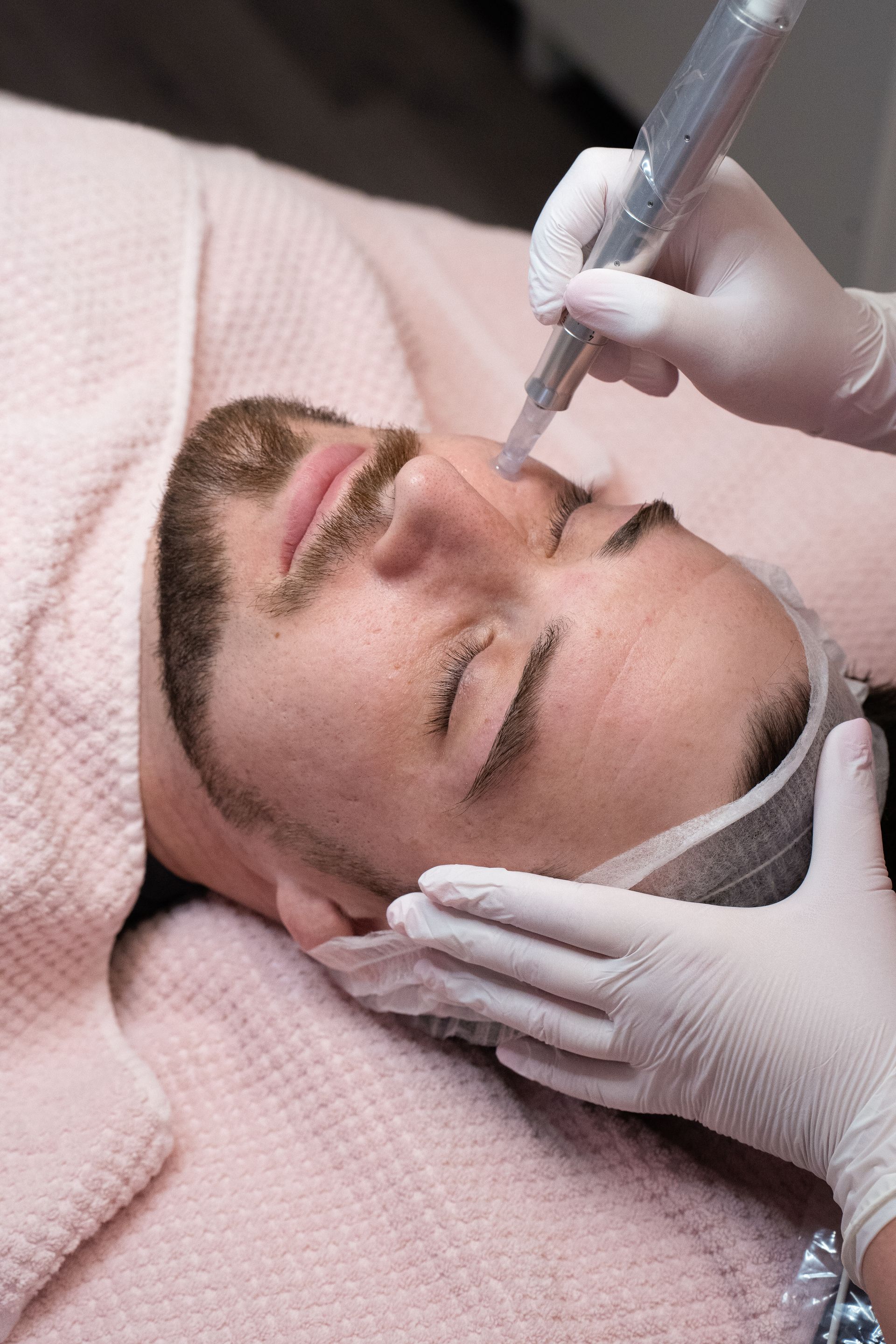 A man is getting a micro needling on his face.