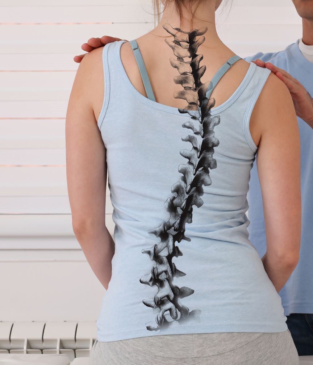 Skoliose Therapie - Dr. Nadja Jiresch - 1010 Wien - Urban Spine