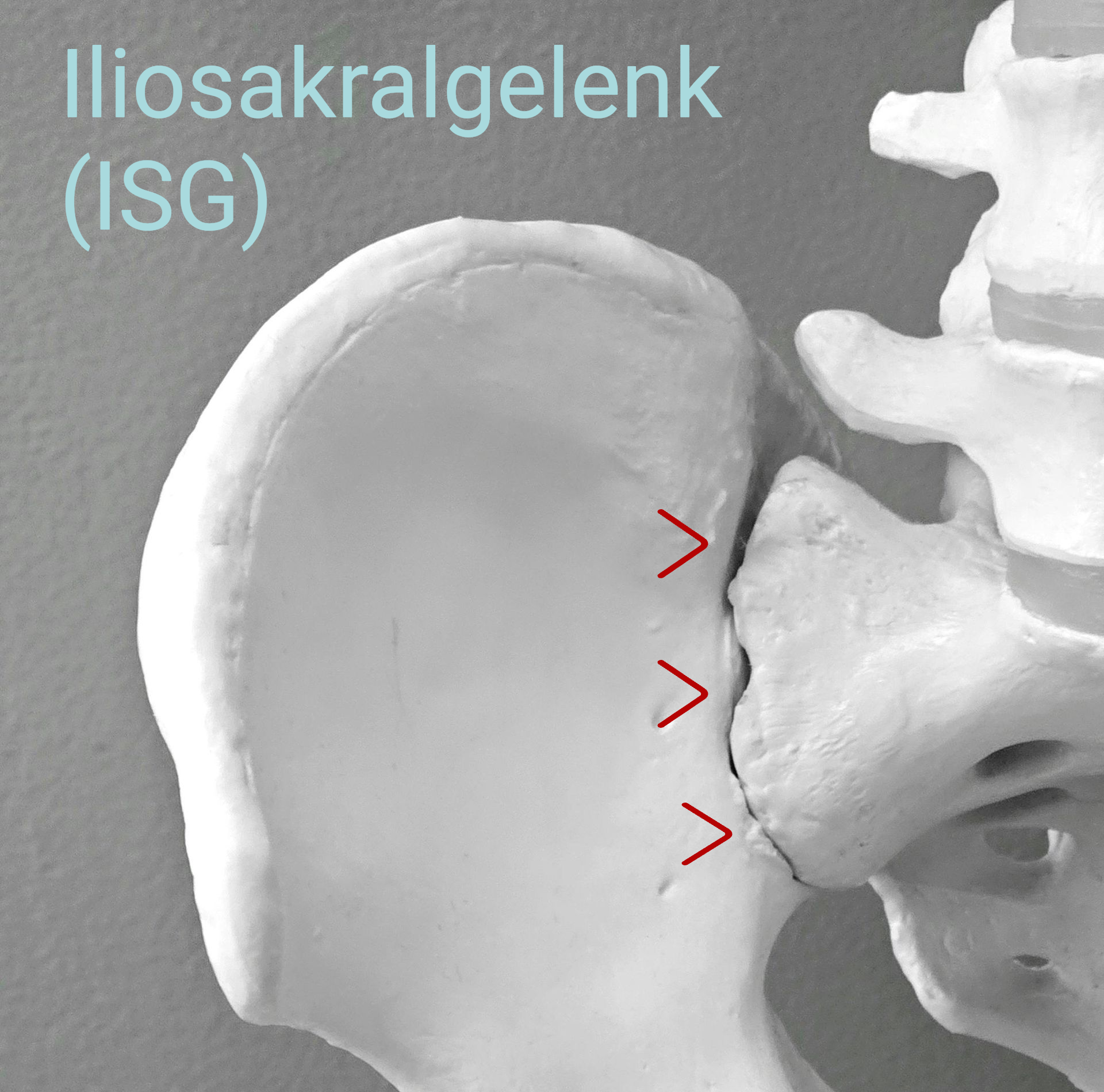ISG Schmerzen verstehen – warum das Iliosakralgelenk oft übersehen wird: OÄ Dr. Nadja Jiresch - 1010 Wien