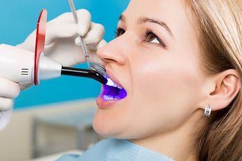 Estetinis dantų plombavimas