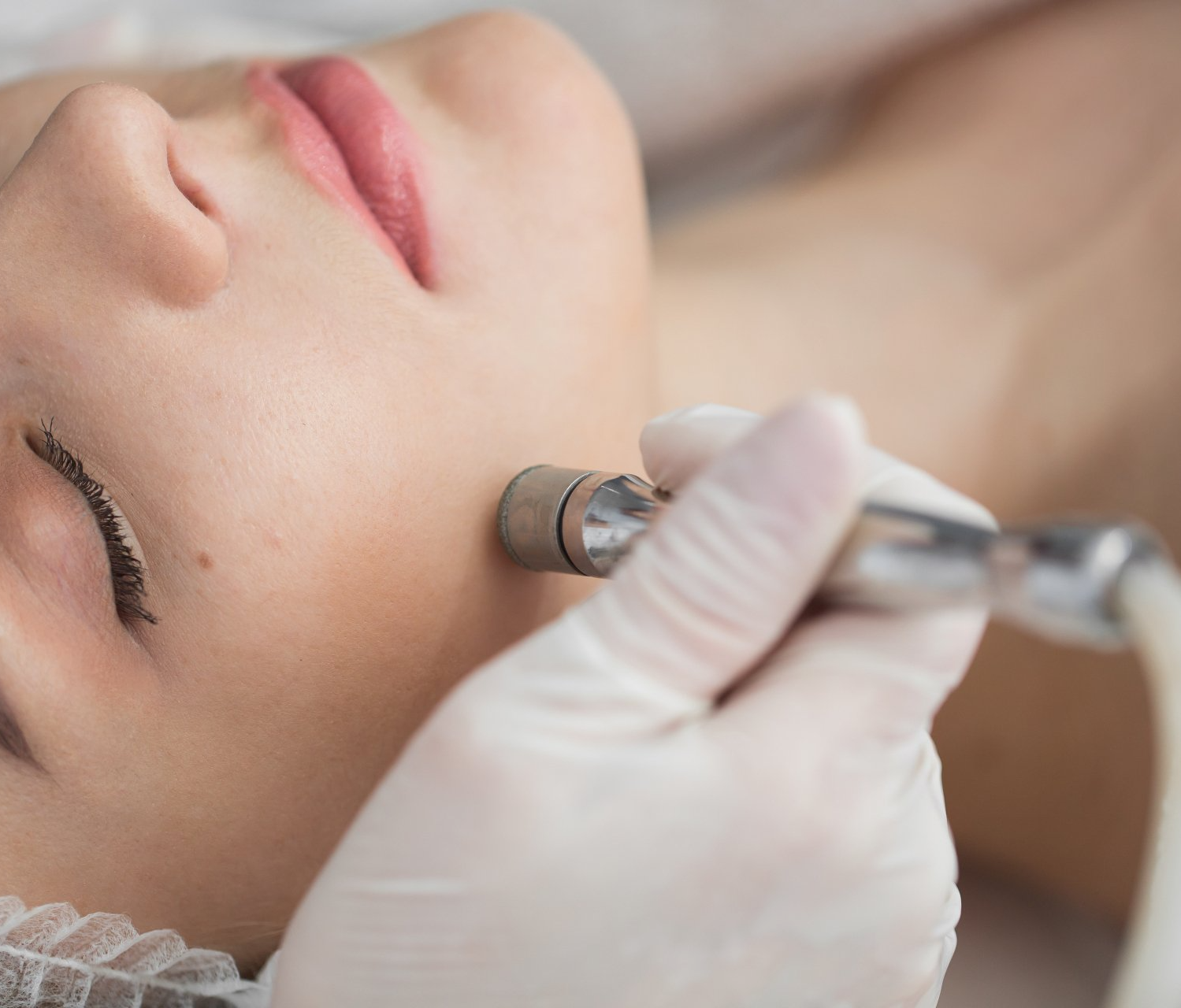 a woman getting microdermabrasion done