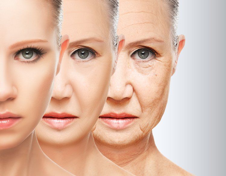 Image of woman showing signs of aging