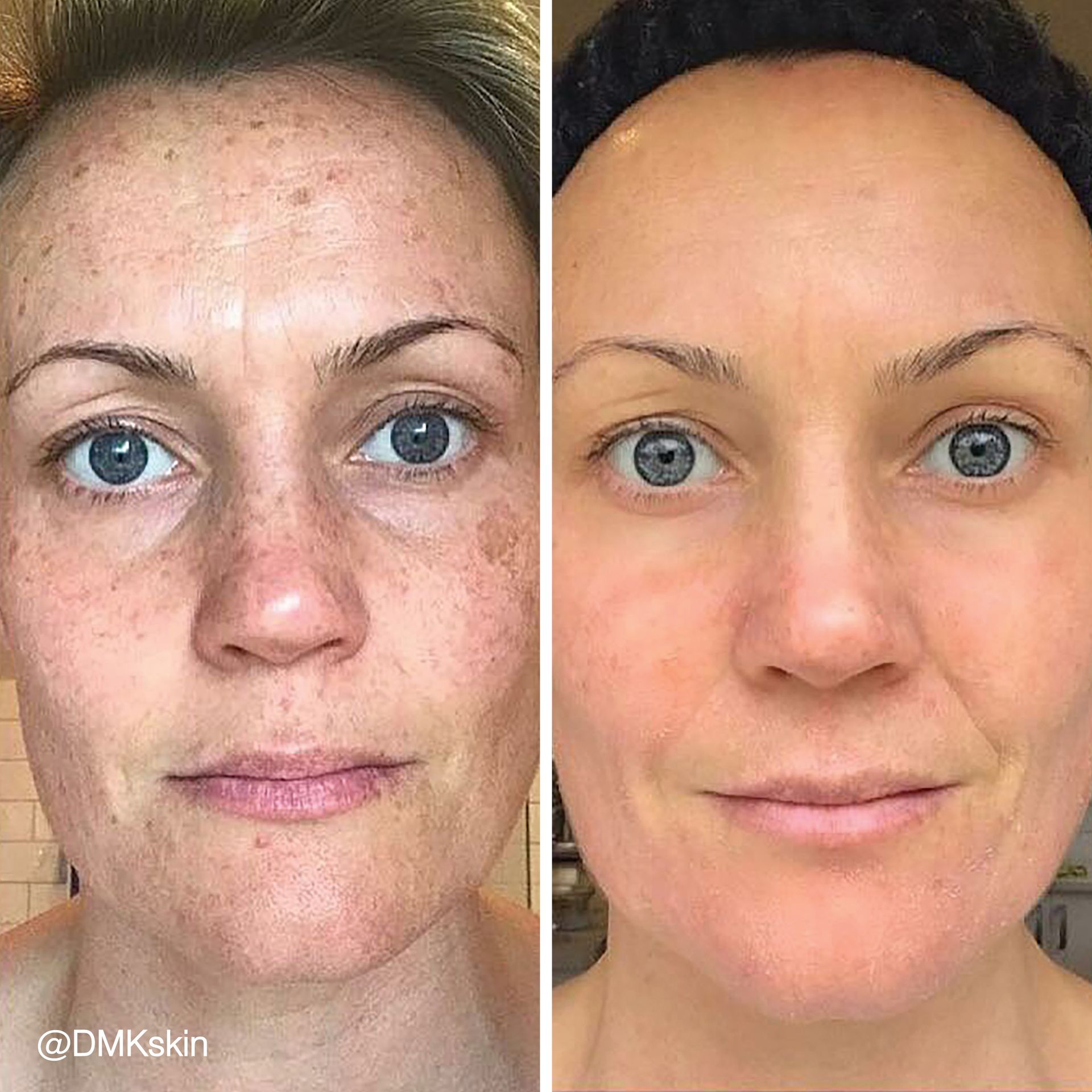 A before and after photo of a woman 's face with and without makeup.