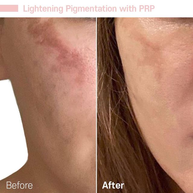 Skin Rejuvination | Tustin, CA | RoseK Medical
