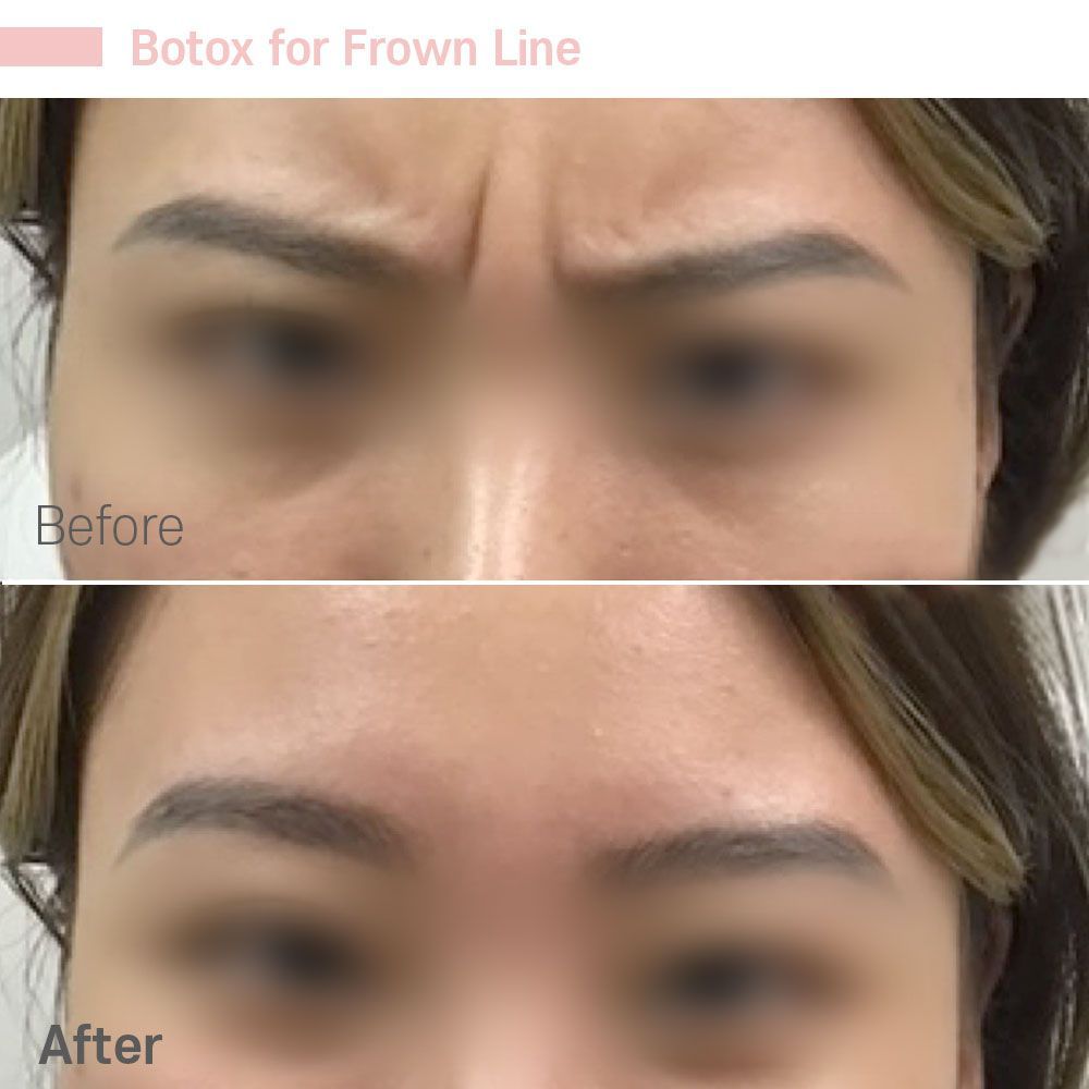 Before And After Fifty One — Tustin, CA — RoseK Medical