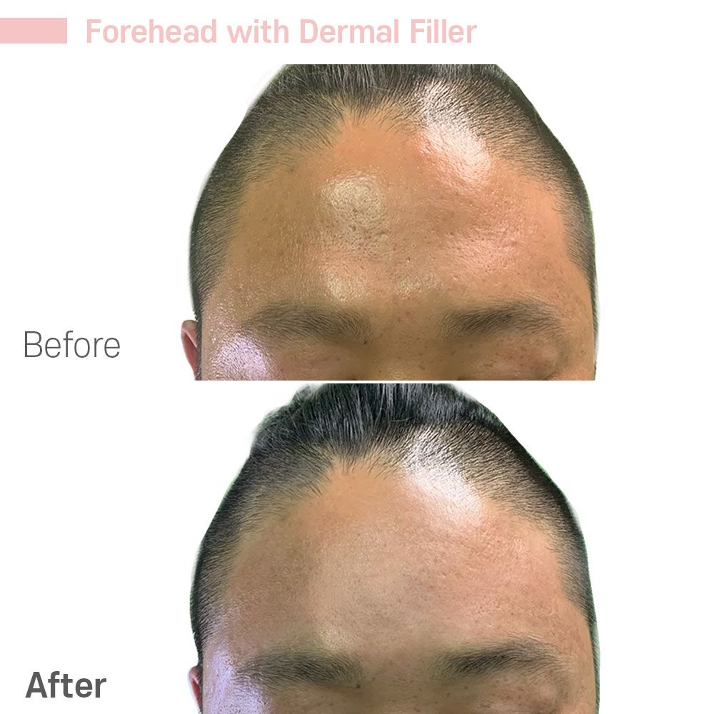 Before And After Forty — Tustin, CA — RoseK Medical