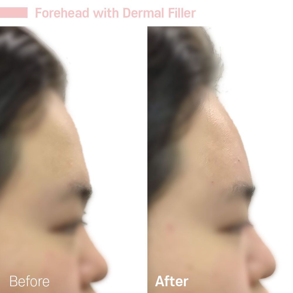 Before And After Forty Six — Tustin, CA — RoseK Medical