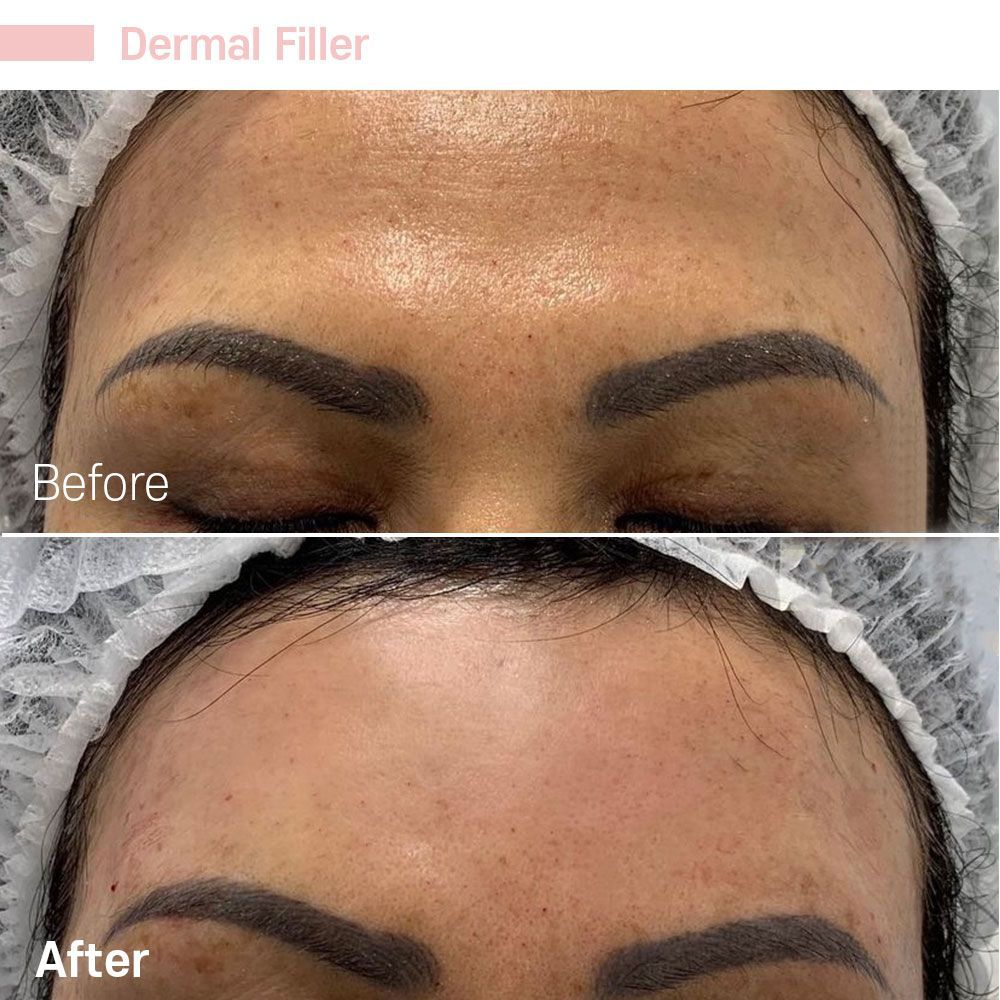 Before And After Thirty Six — Tustin, CA — RoseK Medical