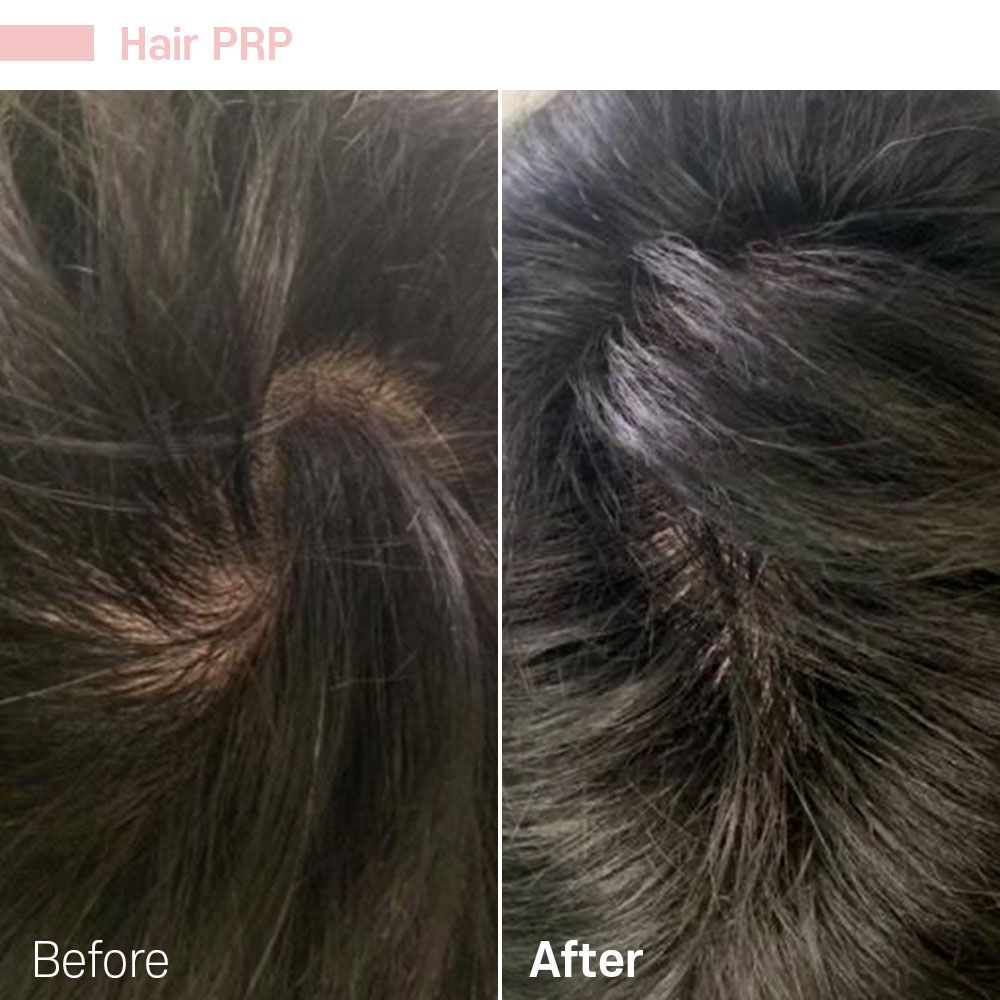 Before And After Thirty Seven — Tustin, CA — RoseK Medical