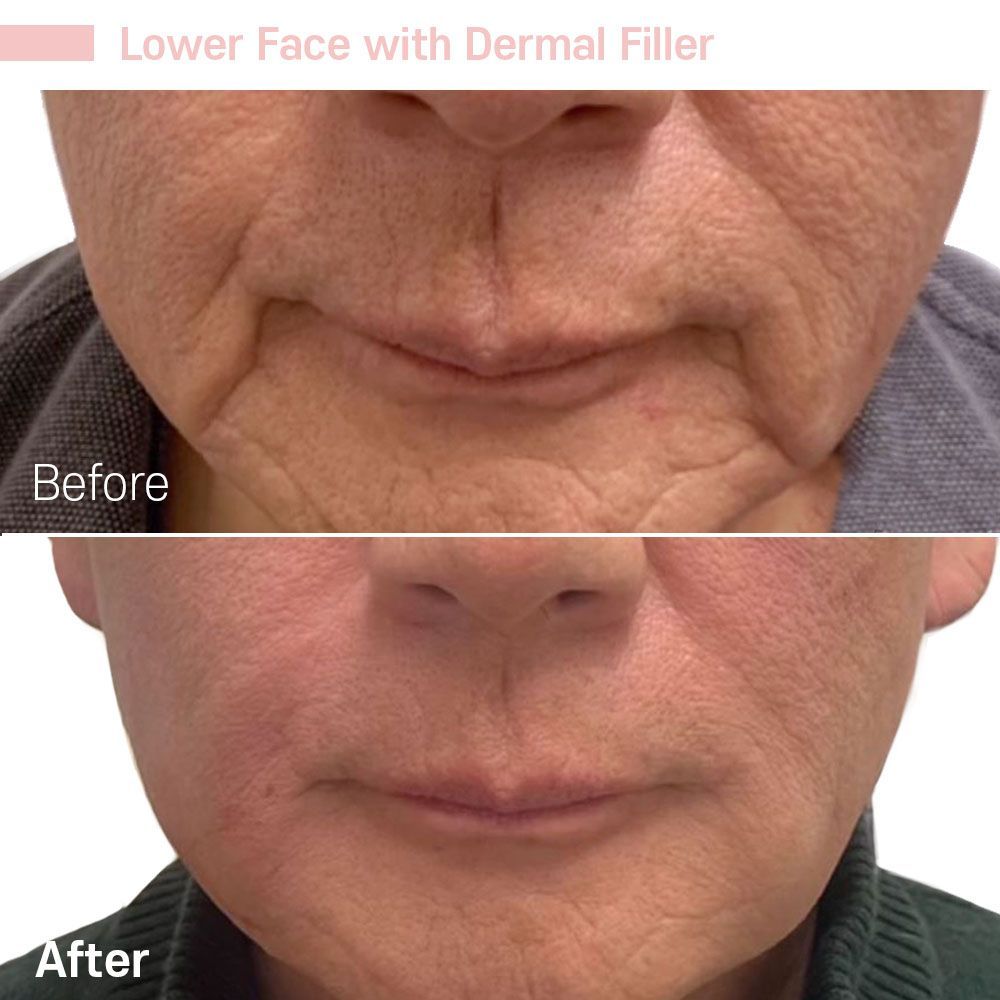 Before And After Seventeen — Tustin, CA — RoseK Medical